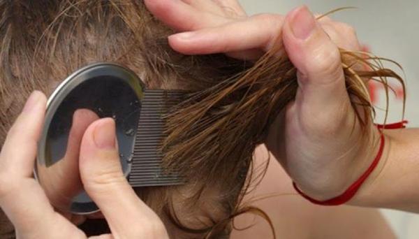 Cara Merawat & Menghilangkan Kutu Rambut Secara Alami
